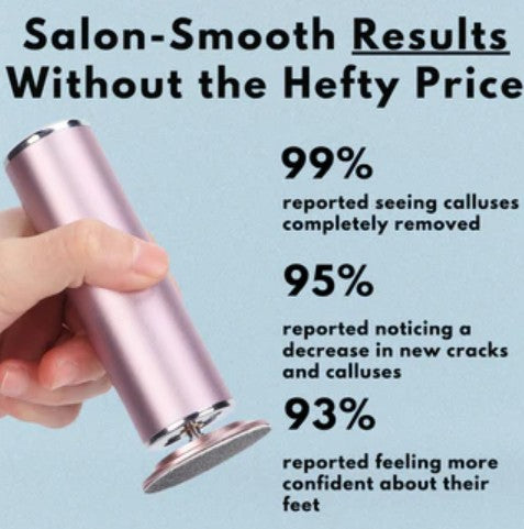 The Original Electric Callus Remover