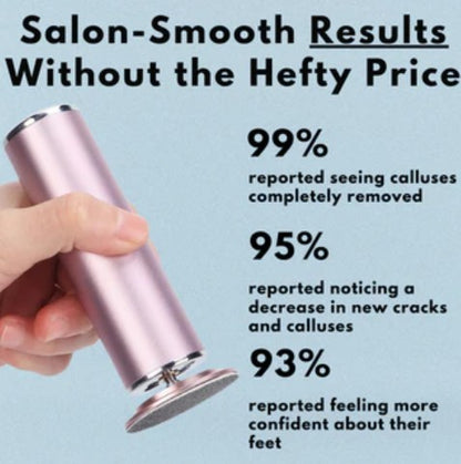 The Original Electric Callus Remover