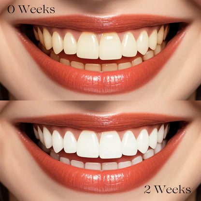 BrightNia™ Whiten. Freshen. Protect.